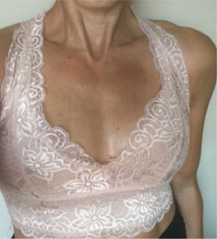 Tania Atkin post surgery