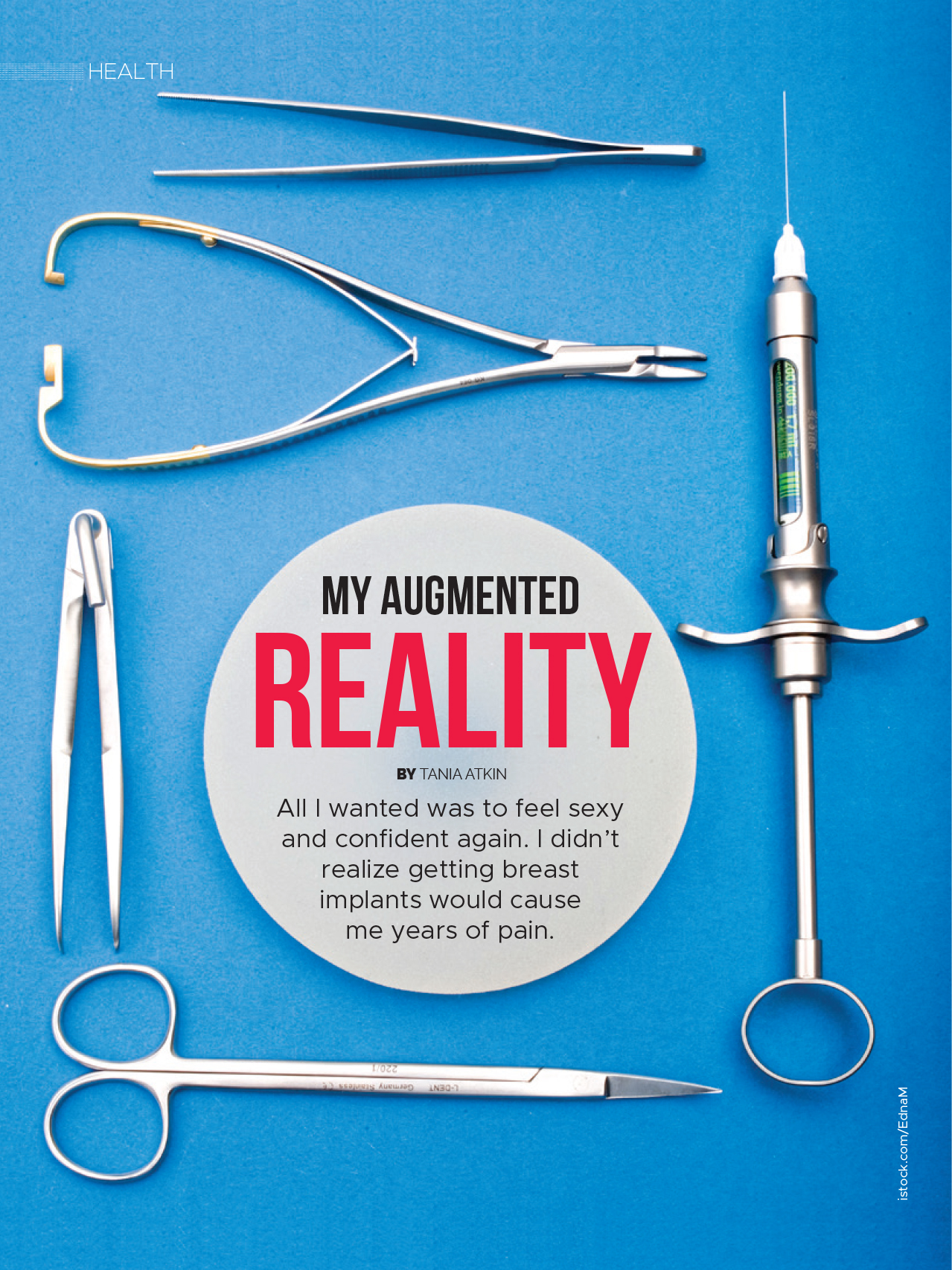 breast implant removal surgery