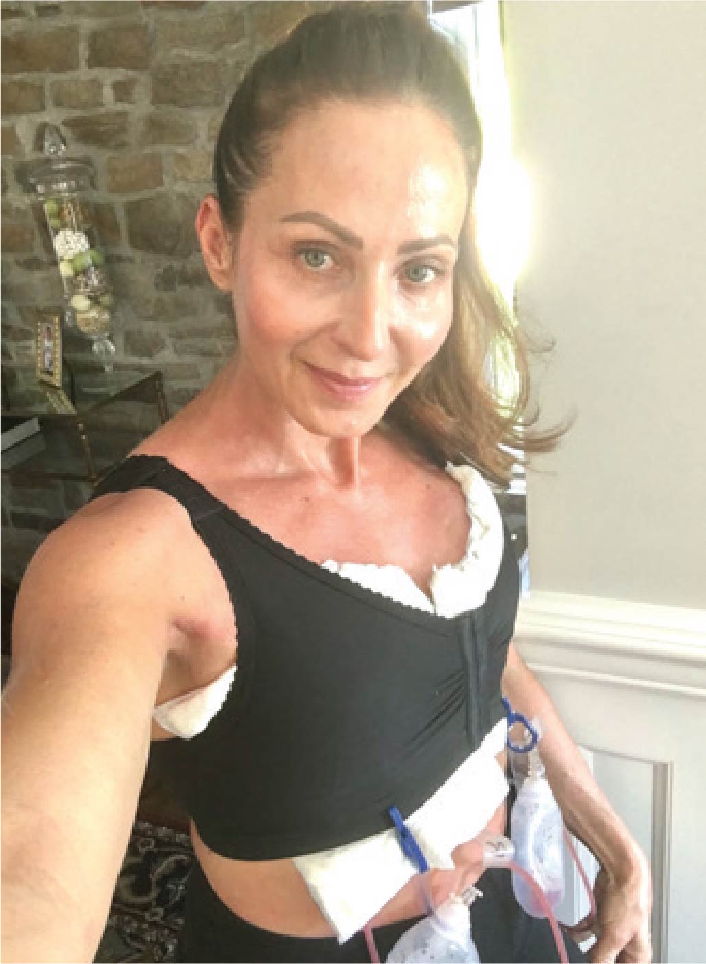 Tania Atkin, breast implant removal